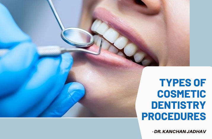 You are currently viewing Types of Cosmetic Dentistry Procedure